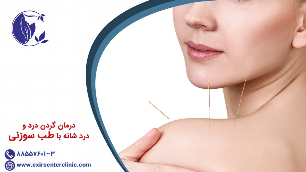 درمان گردن درد و درد شانه با طب سوزنی