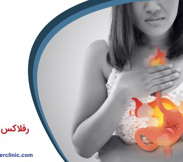 رفلاکس معده چیست؟
