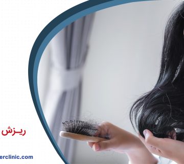 ریزش مو در زنان
