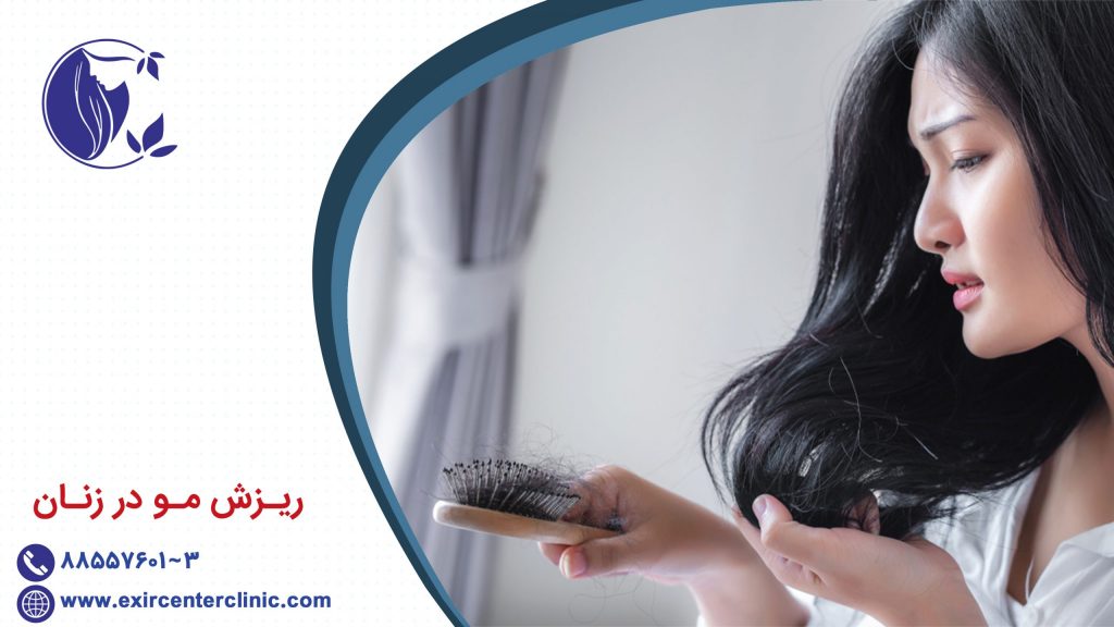ریزش مو در زنان