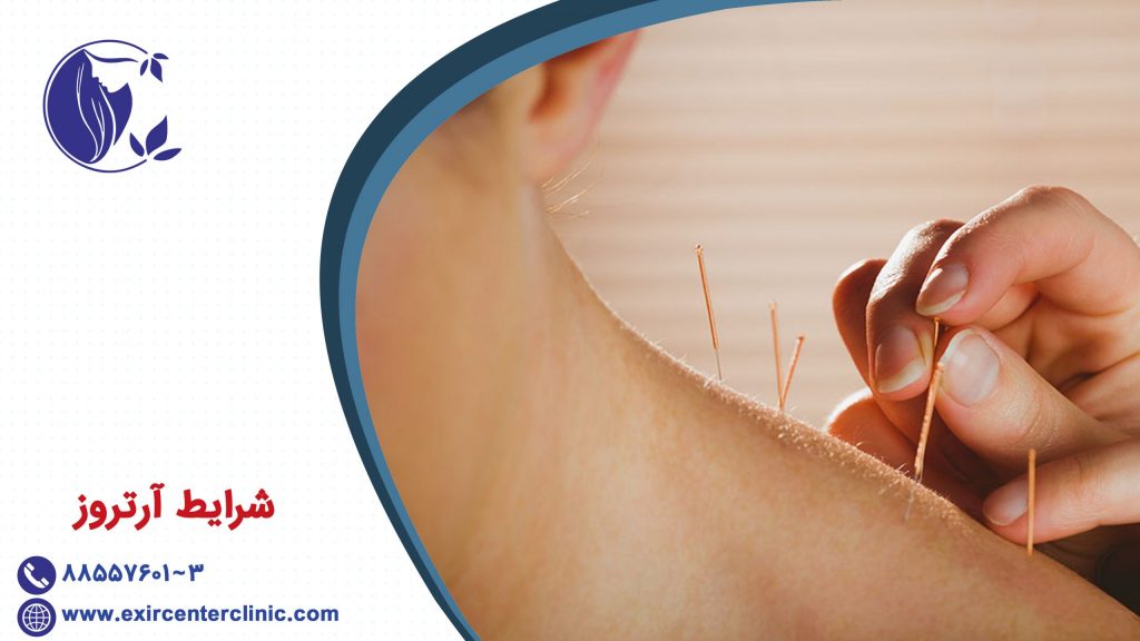 شرایط آرتروز