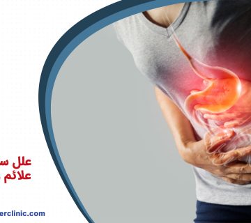 علل سرطان معده، علائم و درمان آن