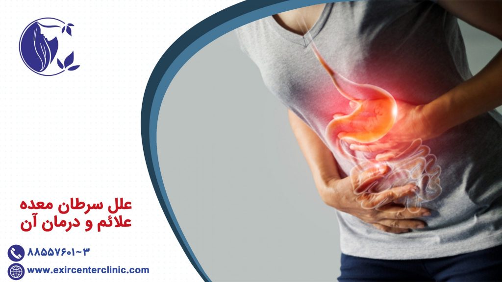 علل سرطان معده، علائم و درمان آن