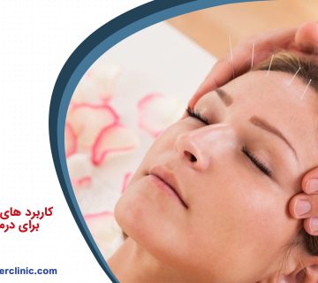 کاربرد های طب سوزنی برای انواع سردرد