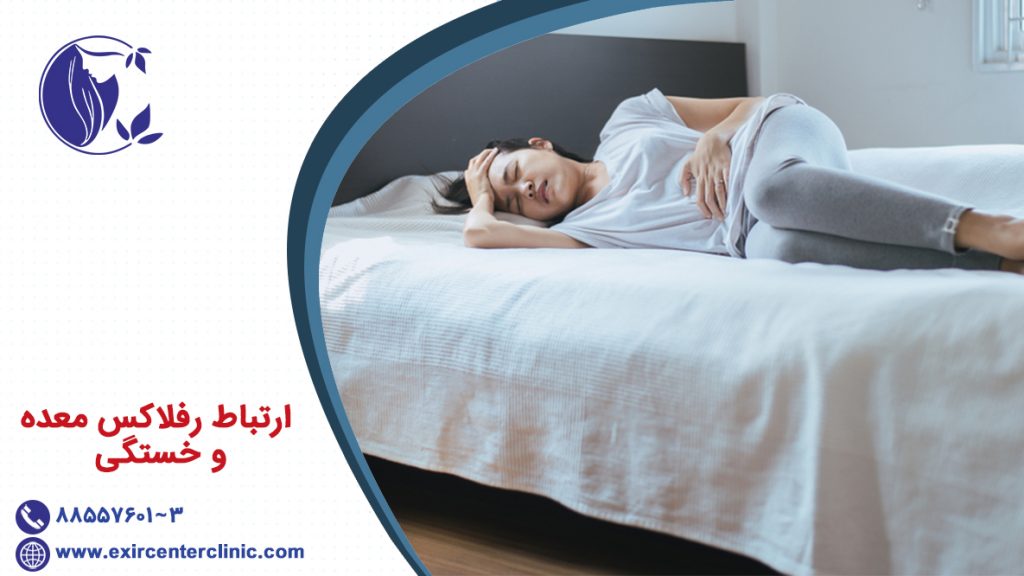 ارتباط رفلاکس معده و خستگی