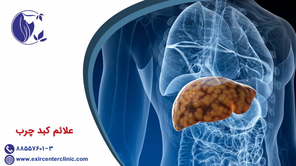 علائم کبد چرب
