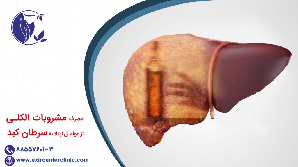 مشروبات الکلی و سرطان کبد