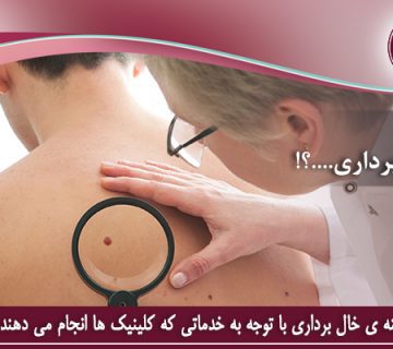 هزینه ی خالبرداری