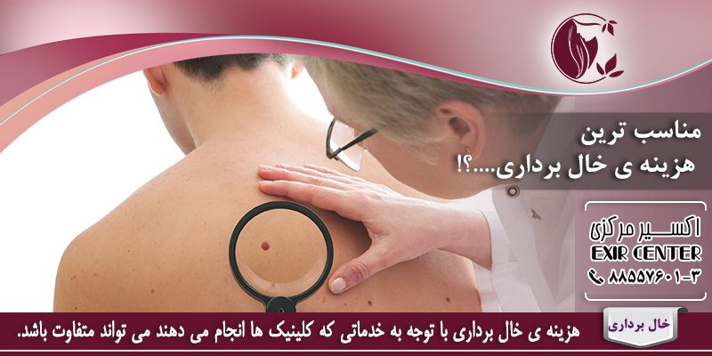 هزینه ی خالبرداری