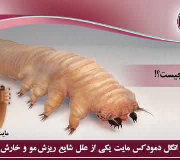 انگل دمودکس
