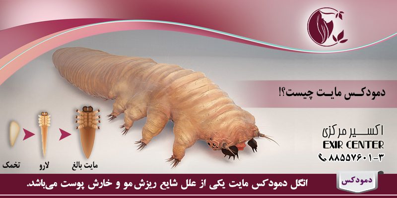 انگل دمودکس