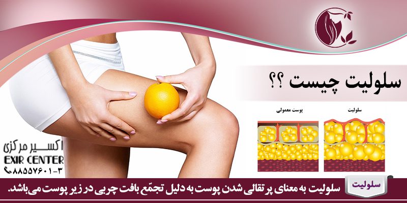 سلولیت چیست؟