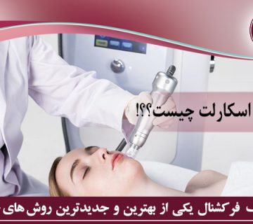 آر اف فرکشنال اسکارلت چیست؟