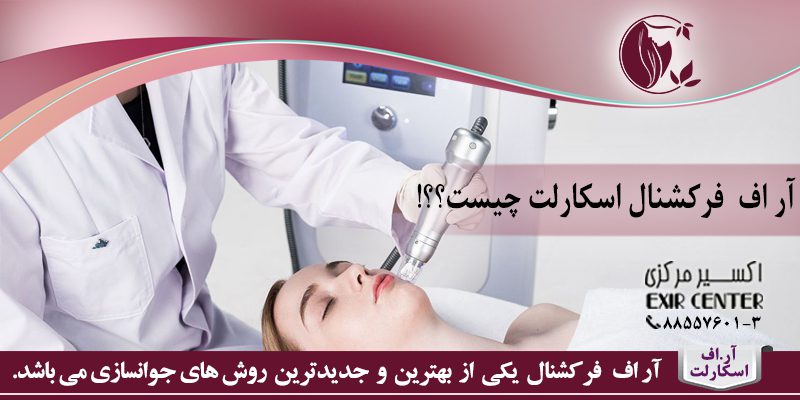 آر اف فرکشنال اسکارلت چیست؟