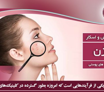 سابسیژن چیست