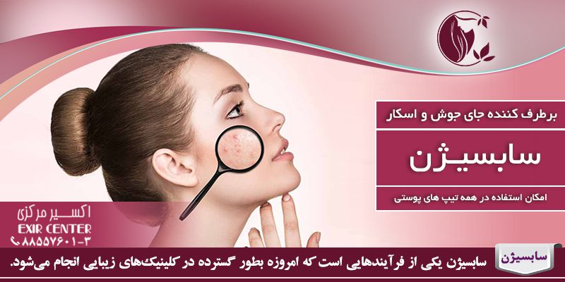 سابسیژن چیست