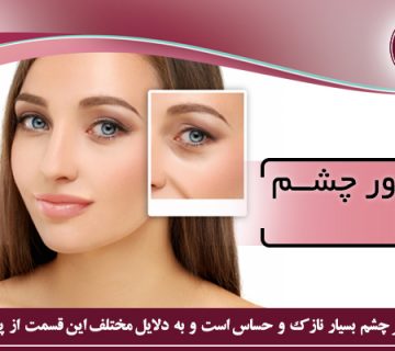 سیاهی دور چشم