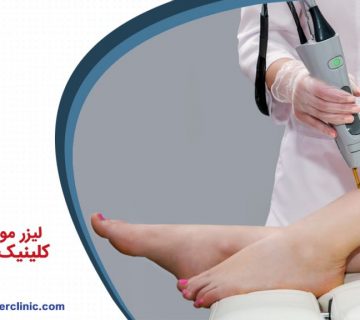 لیزر موهای زائد در کلینیک لیزر اکسیر