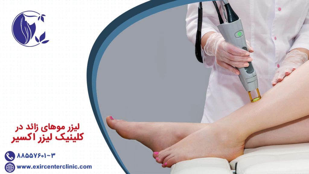 لیزر موهای زائد در کلینیک لیزر اکسیر