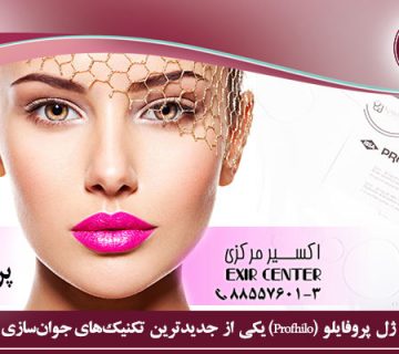 پروفایلو چیست؟