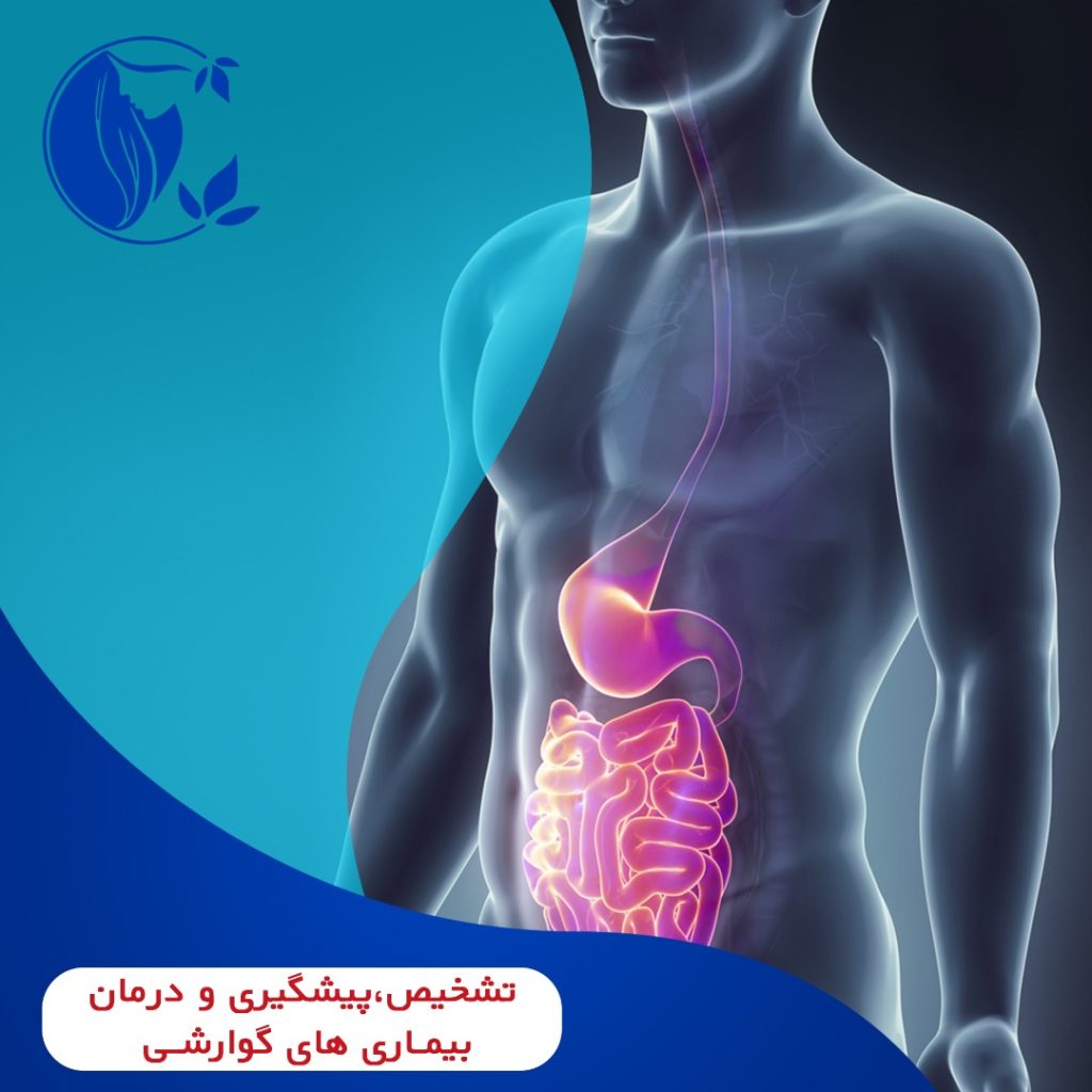 تشخیص بیماری های گوارشی