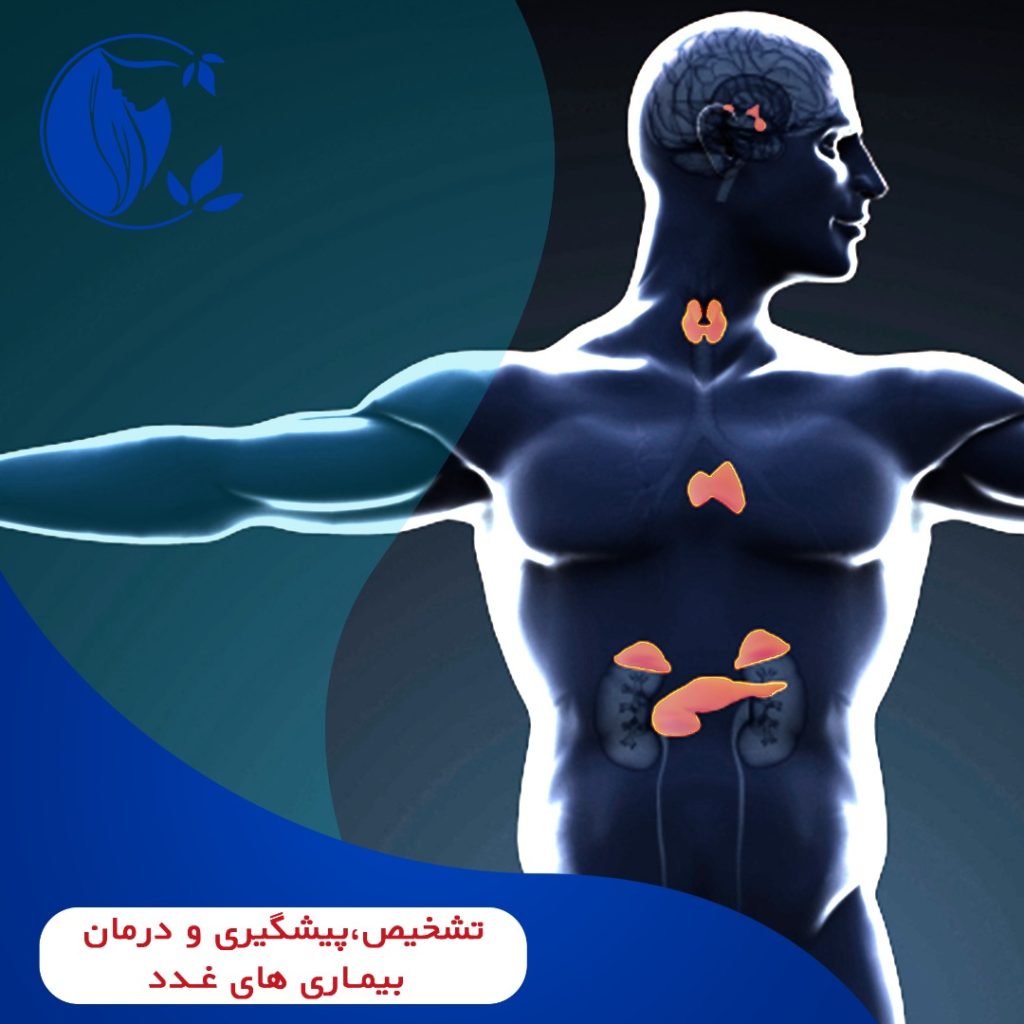 تشخیص بیماری های غدد