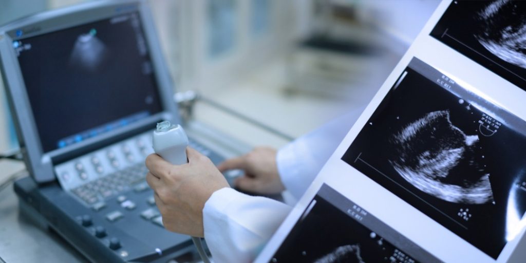 اکوکاردیوگرافی