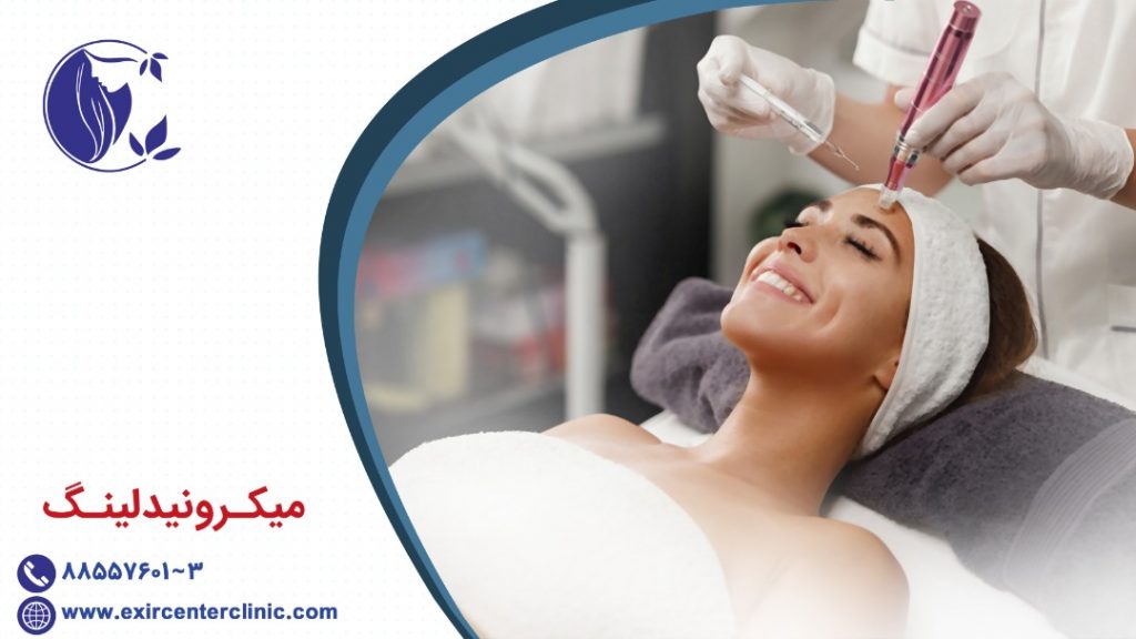 میکرونیدلینگ