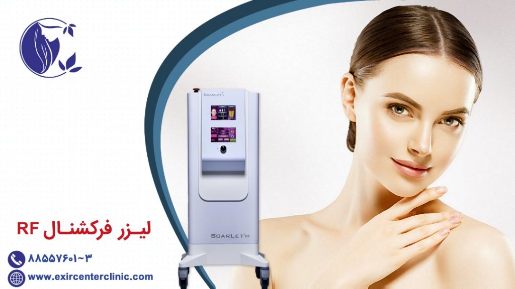 لیزر فرکشنال CO2