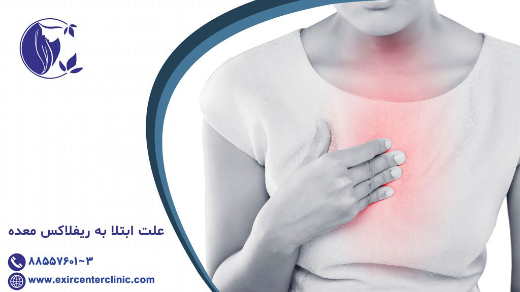 ریفلاکس معده
