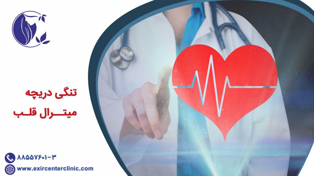 تنگی دریچه میترال قلب