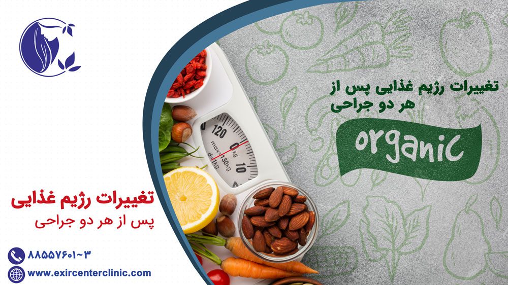 تغییرات رژیم غذایی پس از جراحی