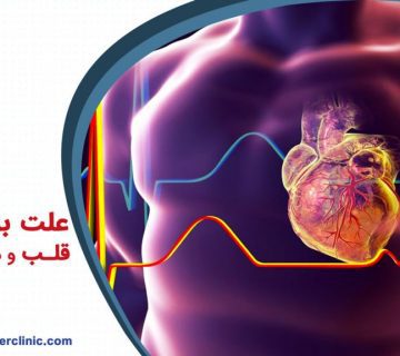 علت بزرگ شدن قلب و درمان آن