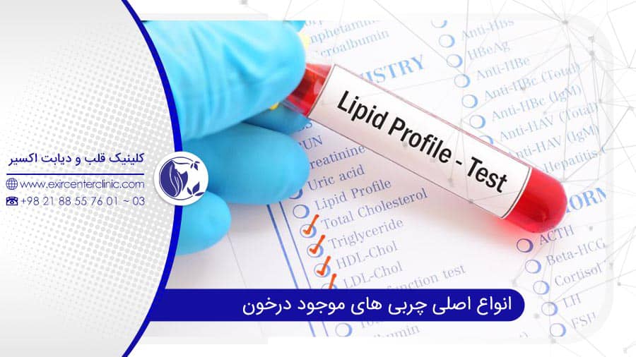 انواع اصلی چربیهای موجود درخون