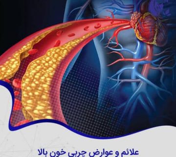 علائم و عوارض چربی خون بالا