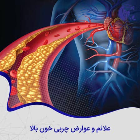 علائم و عوارض چربی خون بالا