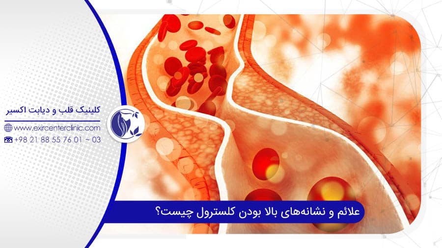 کلسترول بالا چگونه درمان می‌شود؟