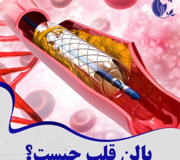 هزینه بالن قلب