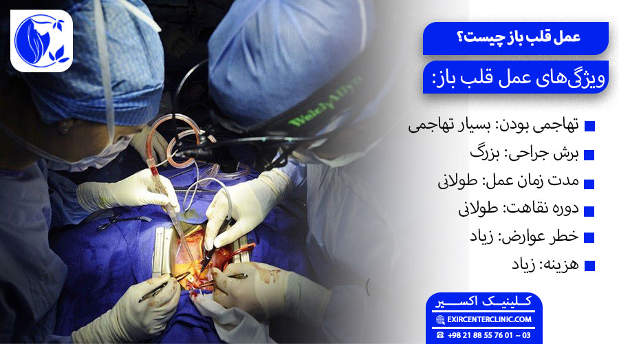 عمل فنر قلب