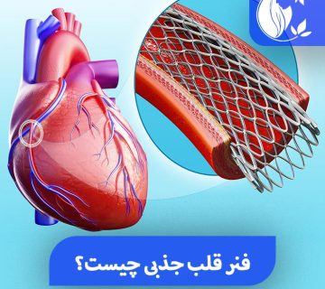 فنر قلب جذبی یا استنت