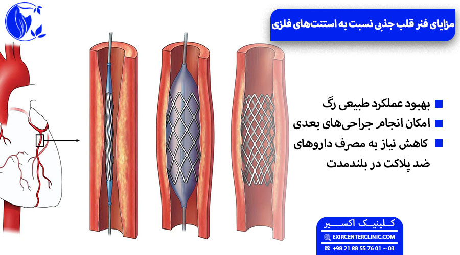 استنت قابل تحلیل