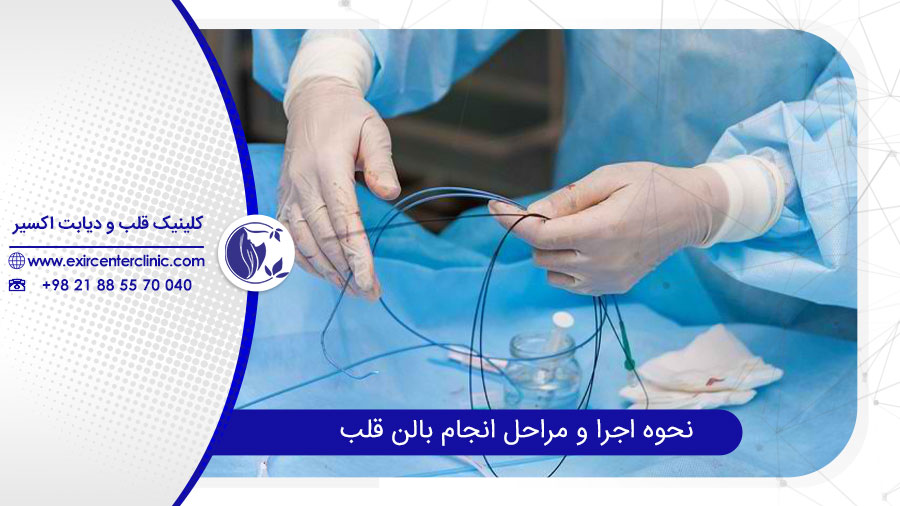 بالن قلب
