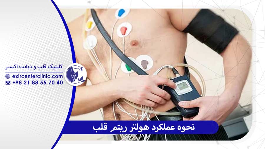 نحوه عملکرد هولتر ریتم قلب