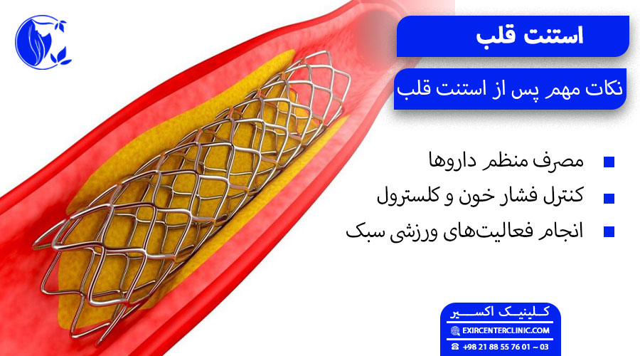 مصرف منظم داروها در زمان استنت گذاری