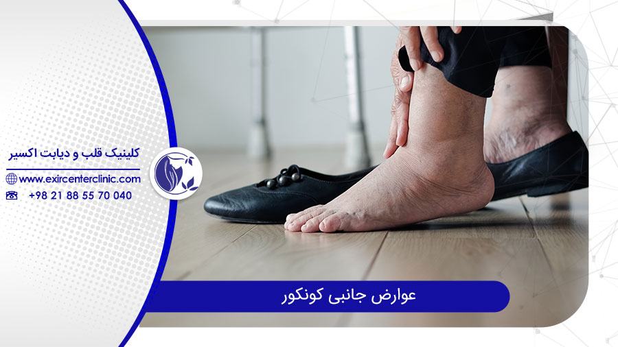 عوارض قرص کنکور