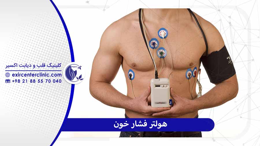 خدمات هولتر قلب 