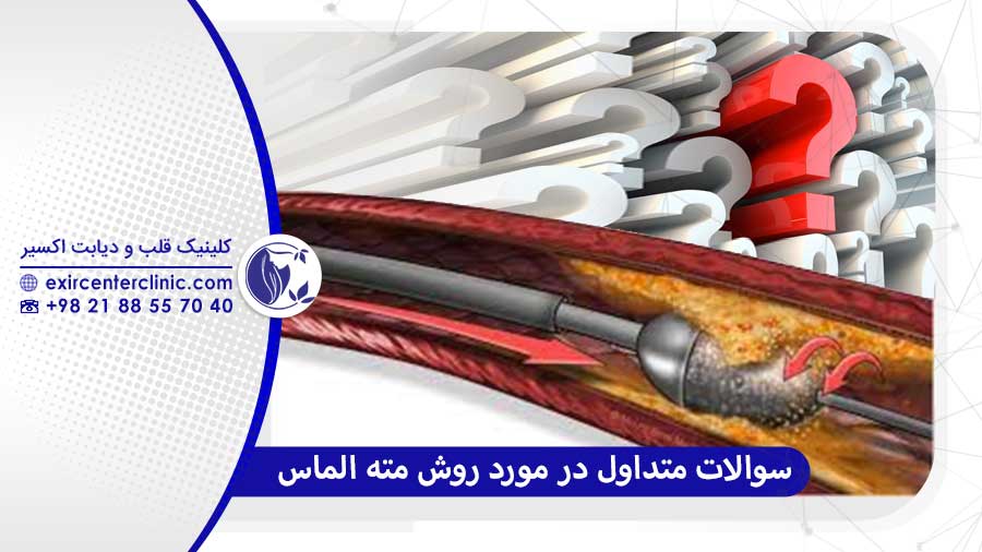 سوالات رایج در مورد روش مته الماس قلب