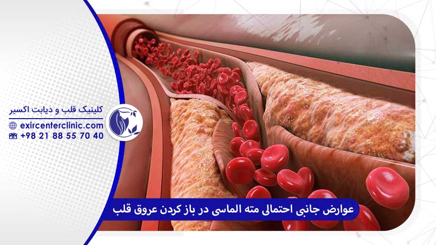 عوارض جانبی احتمالی مته الماس چرخنده