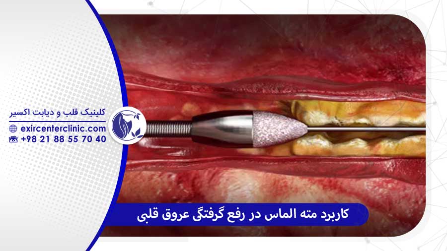 کاربرد مته الماس قلب