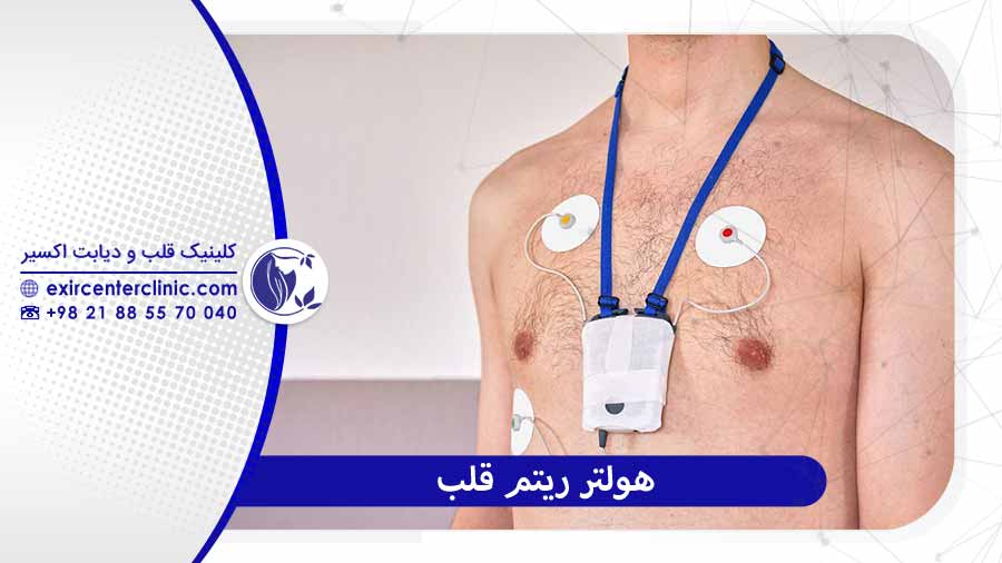 هولتر ریتم قلب